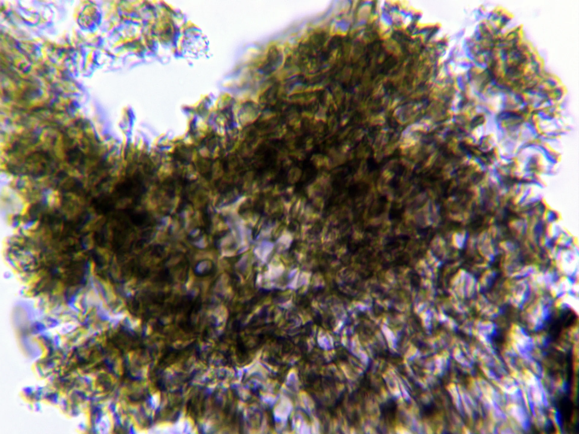 Microscopía de Rhizodiscina lignyota - 11 - Excípulo agua